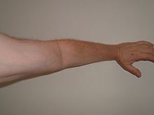 [1] Arm eines Menschen
