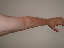 [1] Arm eines Menschen