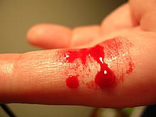 [1] Blut am Finger