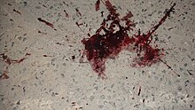 [1] eine Blutspur auf dem Boden