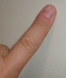 [1] Finger an einer Hand