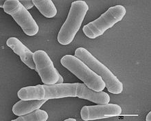 [1] mikroskopische Nahaufnahme einer bestimmten Hefe (Schizosaccharomyces pombe)