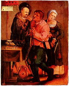 [1] Ein Langfinger bei der Arbeit (Lukas van Leyden, Das Zahnziehen, um 1616)