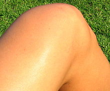 [1] Das Knie einer Frau