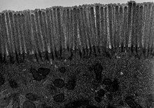 [1] Microvilli in einem menschlichen Leerdarm