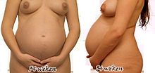 [3] Bauch einer Schwangeren