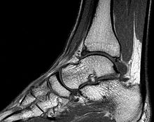 [1] Röntgenaufnahme eines Sprunggelenks